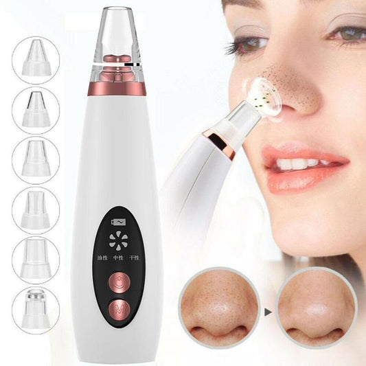 Blackhead Remover Vacuum – Deep Pore Cleaning